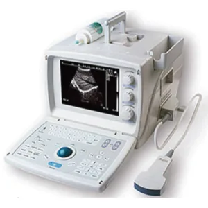 Ultrasound Black White basic portable 9.7" LCD monitor 1 convex probe battery